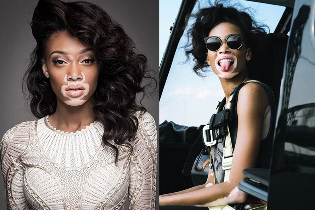 Chantelle Winnie