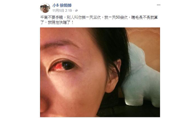 睫毛