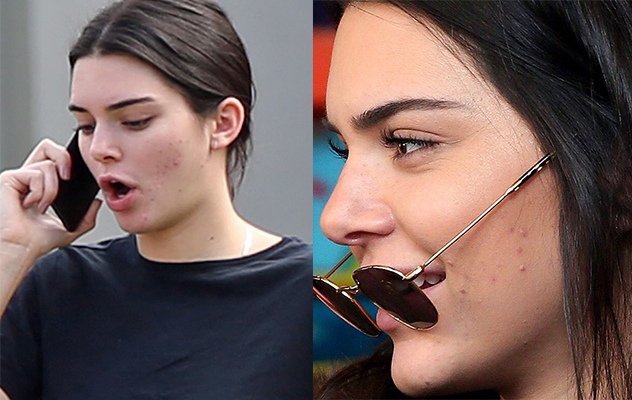 Kendall Jenner