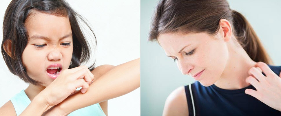 蚊子喜歡叮哪種人呢？研究發現這4種人要特別小心！｜知識文