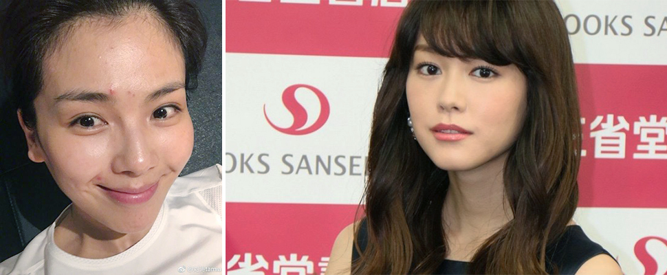 美女也栽在痘痘上，分區治痘才能收復光潔美好的肌膚呀～