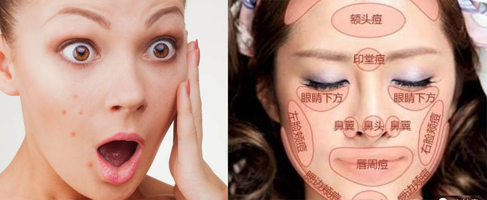 青天可以來，但青春痘拜託不！要！來！