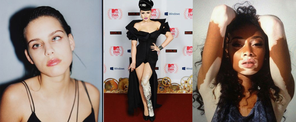 伸展台最美麗的風景！你們口中的缺陷，造就我們與眾不同的魅力